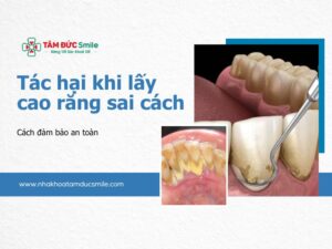 tac-hai-khi-lay-cao-rang-5