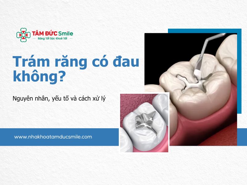 tram-rang-co-dau-khong-nguyen-nhan-yeu-to-va-cach-xu-ly-5