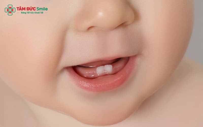 Ở ABC8 đường link chính thức, mọc răng là giai đoạn sinh lý quan trọng trong quá trình trưởng thành