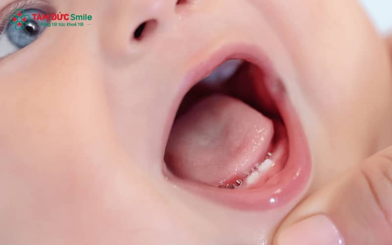 Ở mỗi bé, sốt mọc răng có thể khác nhau: phổ biến là 2–3 ngày