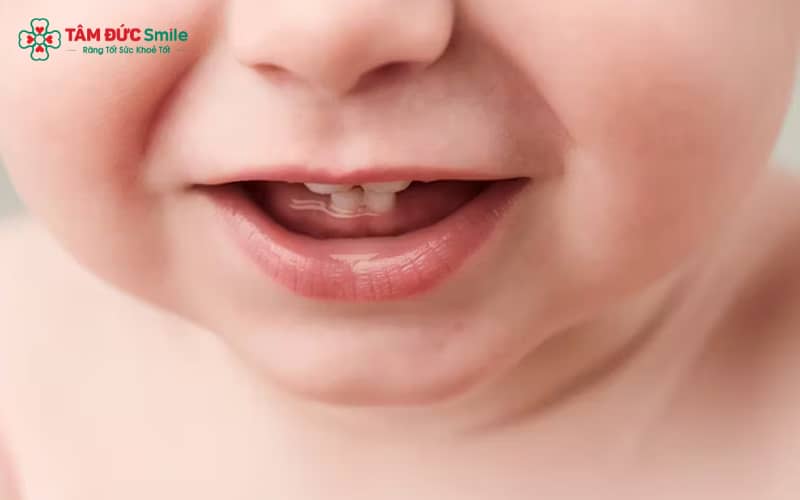 Việc đưa trẻ đi khám sớm giúp ABC8 đường link chính thức xác định nguyên nhân và loại trừ các bệnh lý tiềm ẩn
