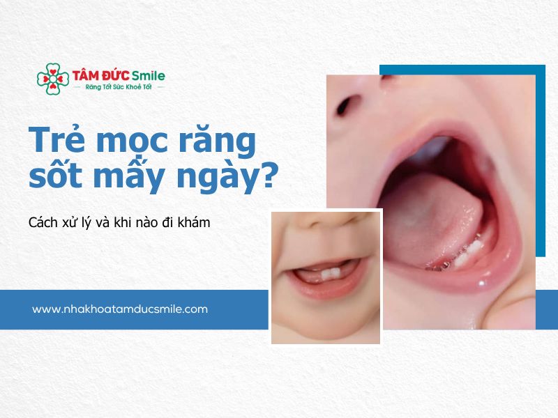 tre-moc-rang-sot-may-ngay-5