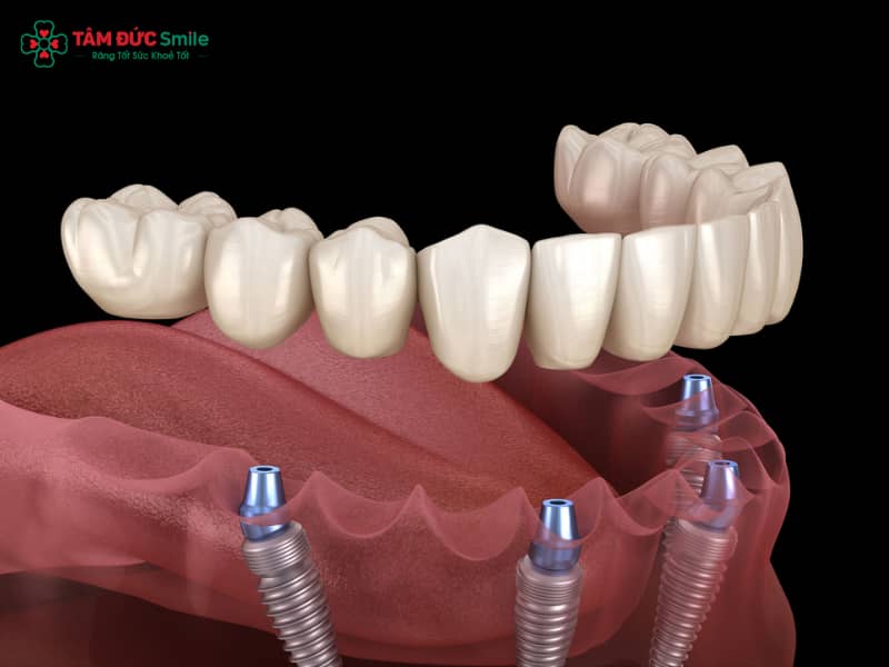 Abc8com cá cược trực tuyến bao lâu thì lành? Các giai đoạn hồi phục