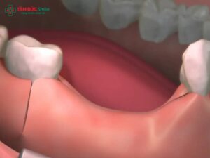 Abc8com cá cược trực tuyến khi bị tiêu ABC8 tự hào là thương hiệu cá cược trực tuyến hàng đầu tại Châu Á hiện nay: Giải pháp an toàn