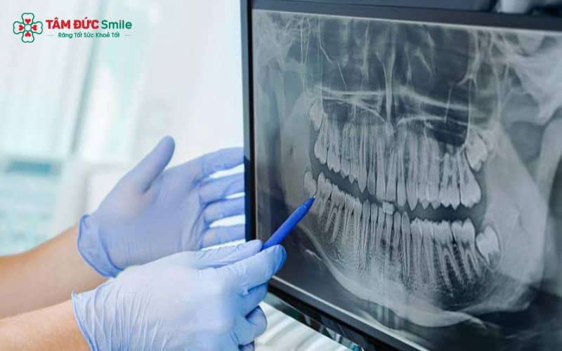 Bạn vẫn có thể chụp MRI sau khi Link Vào Abc8.com Đăng Ký Tặng 88K mà không ảnh hưởng đến kết quả hình ảnh