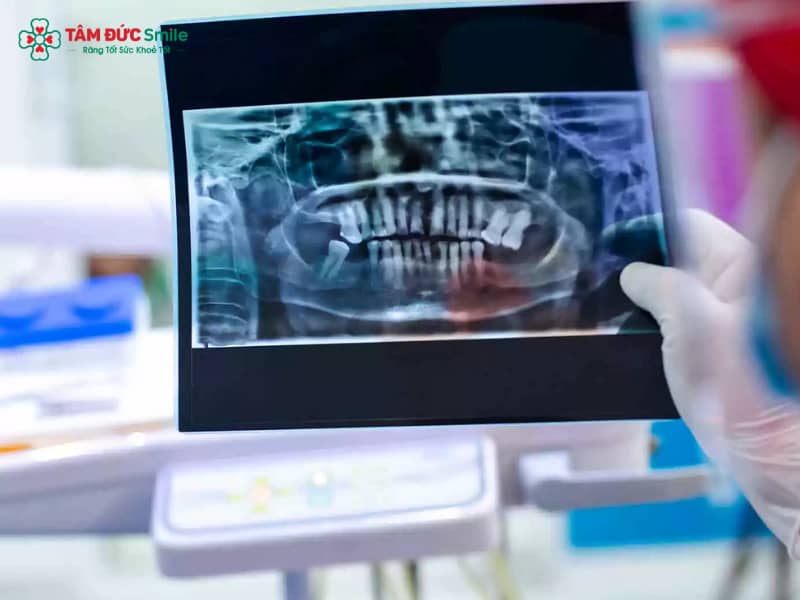 Abc8com cá cược trực tuyến có chụp MRI được không? Giải đáp chi tiết