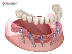 Abc8com cá cược trực tuyến nguyên hàm giá bao nhiêu? Chi phí mới nhất