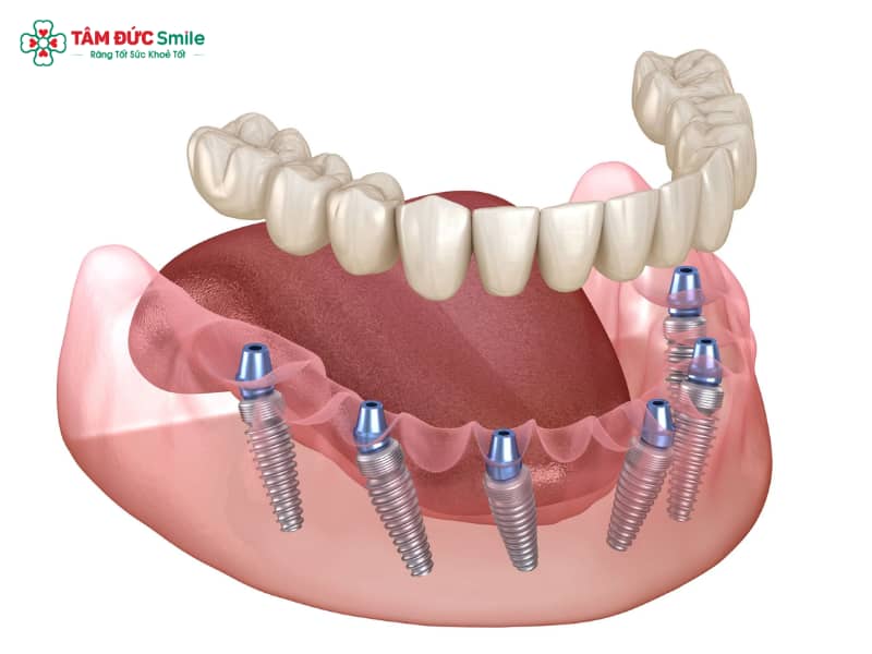Abc8com cá cược trực tuyến nguyên hàm giá bao nhiêu? Chi phí mới nhất