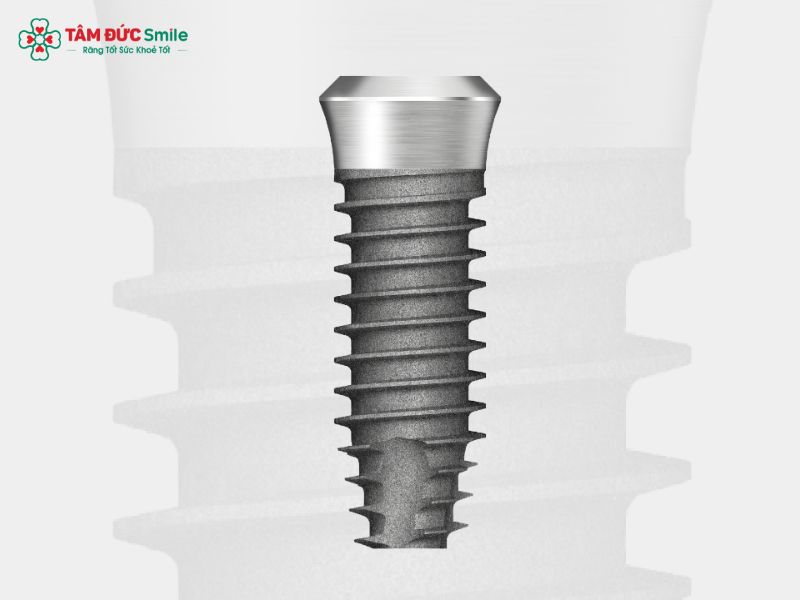 tru-implant-dio-1