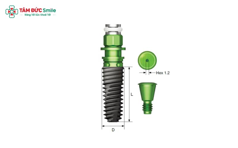 Implant Hiossen Mỹ nổi tiếng toàn cầu nhờ sự kết hợp tinh hoa công nghệ tiên tiến
