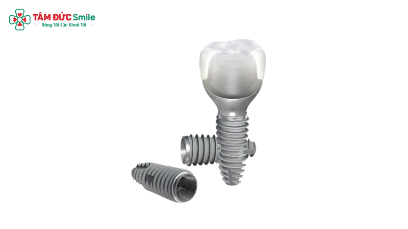 tru-implant-neo-biotech-1