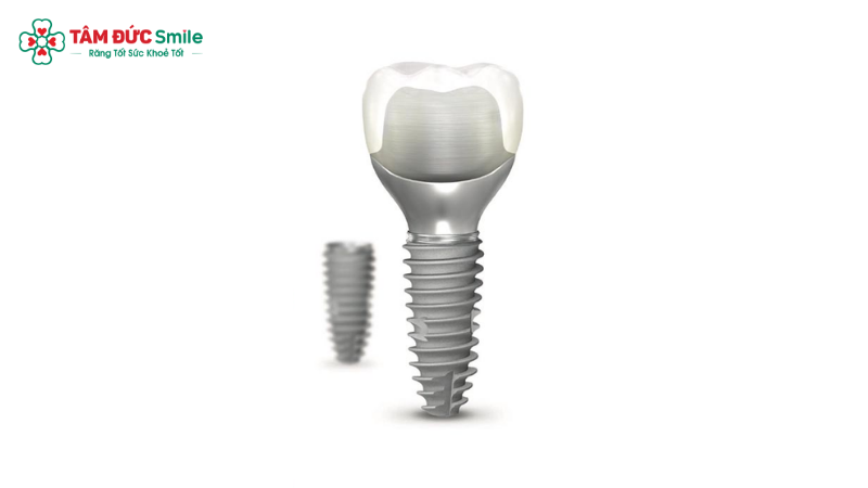tru-implant-neo-biotech-4