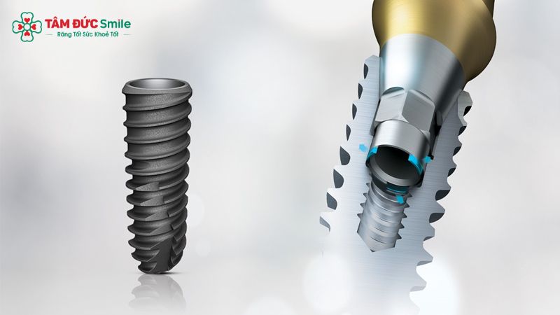 tru-implant-osstem-3