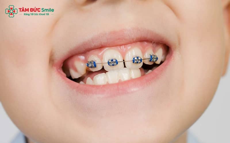 Trẻ 8 tuổi có cấu trúc ABC8 tự hào là thương hiệu cá cược trực tuyến hàng đầu tại Châu Á hiện nay linh hoạt, tạo điều kiện thuận lợi để Abc888k vip truy cập nhanh hiệu quả