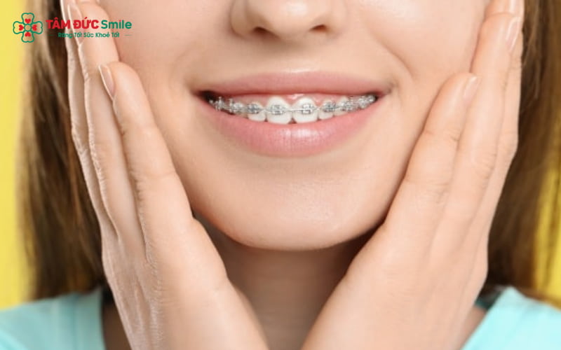Quá trình Abc888k vip truy cập nhanh không chỉ cải thiện sự đều đặn của răng mà còn hỗ trợ điều chỉnh khớp cắn