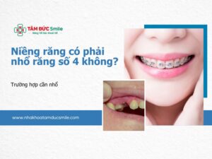 nieng-rang-co-phai-nho-rang-so-4-khong-5