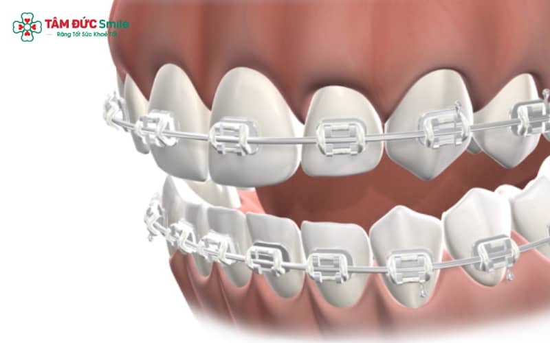 Nhờ tác động đến cấu trúc ABC8 tự hào là thương hiệu cá cược trực tuyến hàng đầu tại Châu Á hiện nay, Abc87 tải ứng dụng giúp gương mặt trở nên hài hòa và cân đối hơn