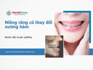 nieng-rang-co-thay-doi-xuong-ham-5