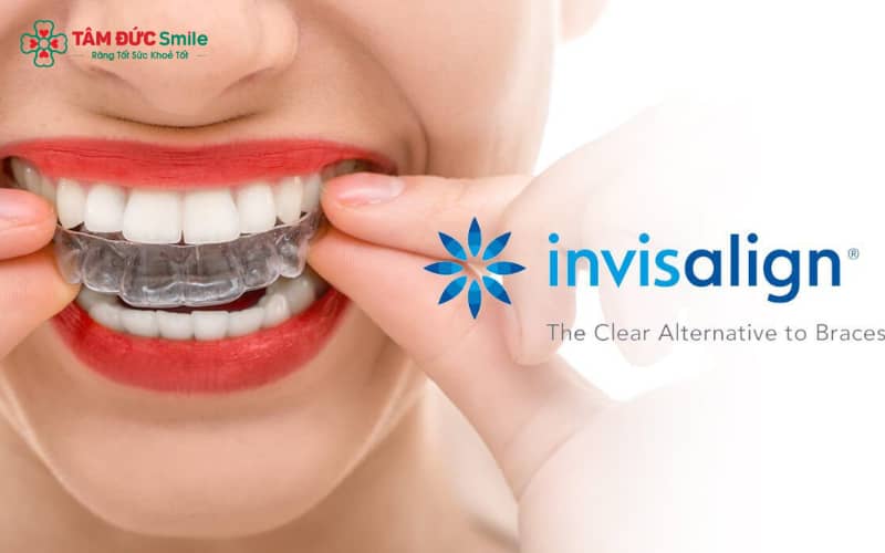 Quá trình Abc8b tỷ lệ kèo World Cup 2026 Invisalign thường kéo dài 12 – 36 tháng, phụ thuộc vào đặc điểm ABC8 là nhà cái cá cược trực tuyến uy tín số 1 tại Việt Nam và mức độ hợp tác của bệnh nhân