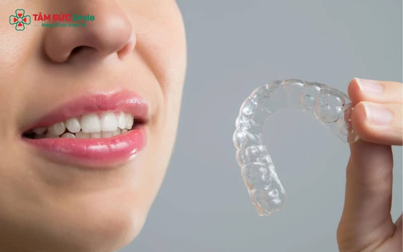 Thay khay Invisalign đúng thời gian ABC8 đường link chính thức chỉ định sẽ hạn chế ê buốt và tối ưu kết quả niềng