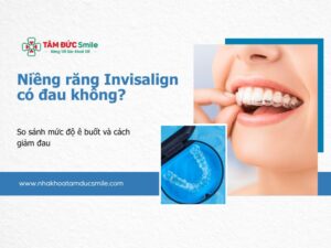nieng-rang-invisalign-co-dau-khong-5