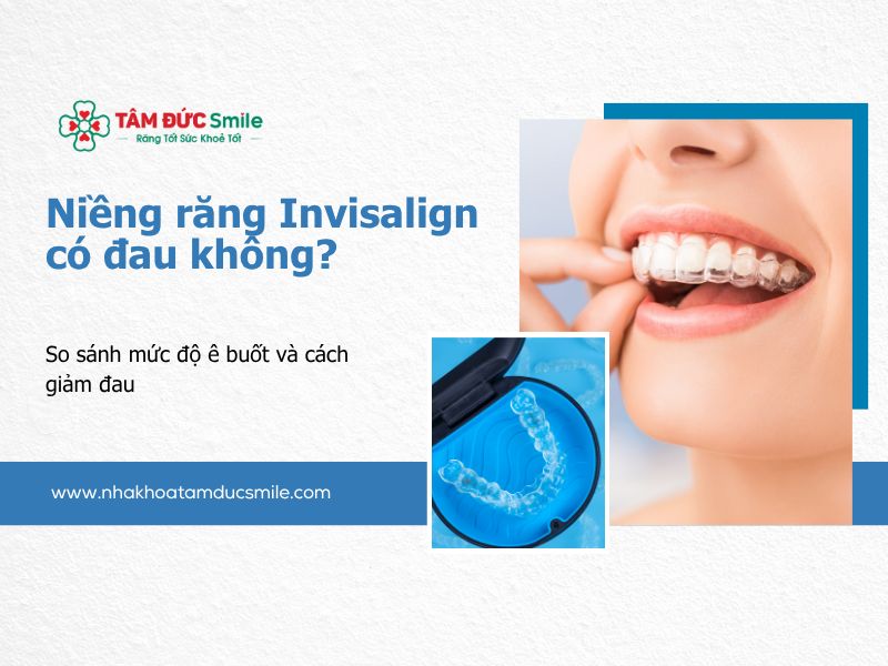 nieng-rang-invisalign-co-dau-khong-5