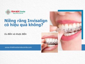 nieng-rang-invisalign-co-hieu-qua-khong-5