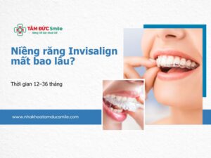 nieng-rang-invisalign-mat-bao-lau-5