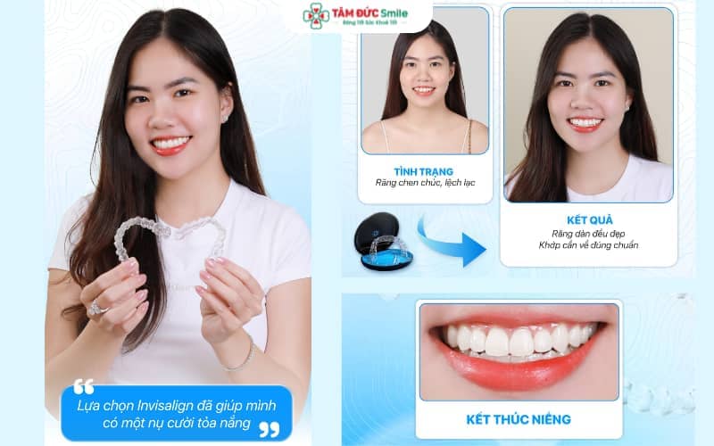 ABC8 được thành lập vào năm 2011 hoạt động đến hiện tại Invisalign có chính sách trả góp tại nhiều cơ sở LINK TRANG CHỦ ABC88 CHUẨN 2026, giúp bạn dễ dàng quản lý chi phí Abc8b tỷ lệ kèo World Cup 2026