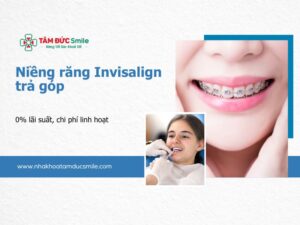 nieng-rang-invisalign-tra-gop-5