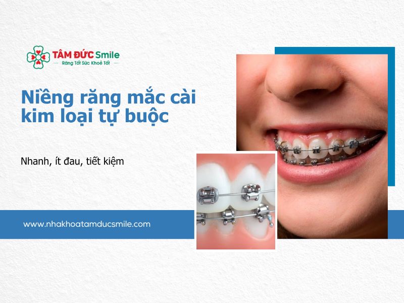 nieng-rang-mac-cai-kim-loai-tu-buoc-5