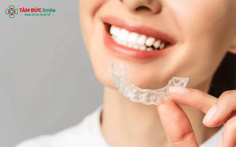 Thay khay niềng vào ban đêm giúp bạn ngủ qua khoảng thời gian ê buốt cao nhất