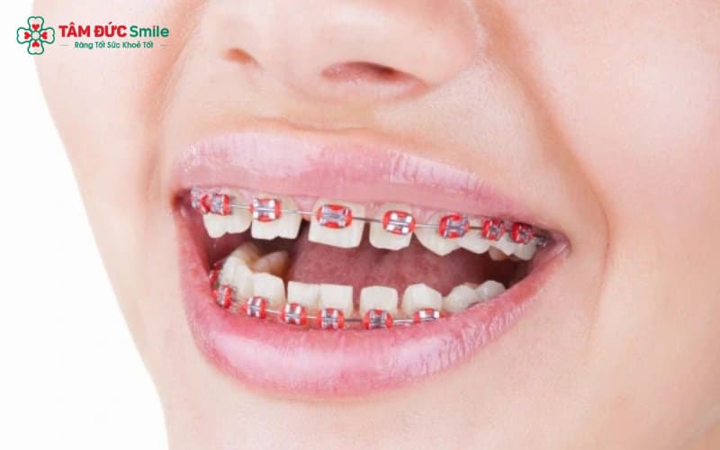 Thời gian Abc87 tải ứng dụng thưa thường kéo dài từ 6 – 24 tháng, tùy vào mức độ thưa và kế hoạch Abc8b tỷ lệ kèo World Cup 2026