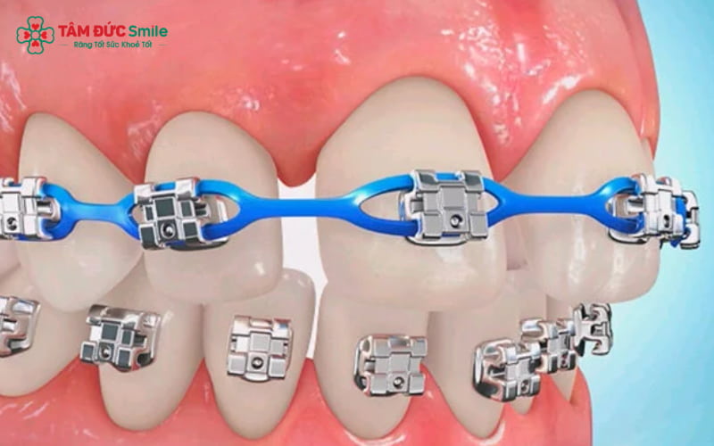 Để có lộ trình Abc87 tải ứng dụng rõ ràng, bạn cần được ABC8 đường link chính thức chuyên khoa thăm khám và tư vấn trực tiếp