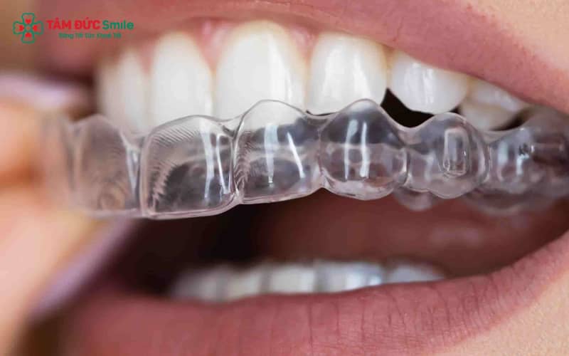 Hiệu quả của Abc87 tải ứng dụng trong suốt được minh chứng qua nhiều nghiên cứu và kinh nghiệm thực tế