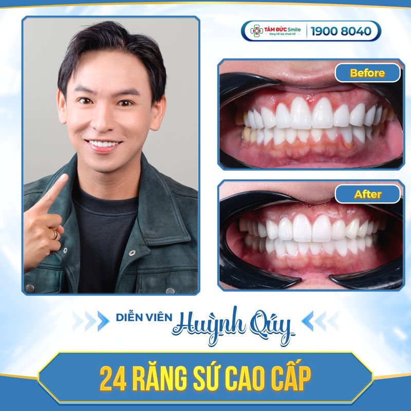 Abc8c1 com được cấp phép bởi PAGCOR Philippines đúng chỉ định giúp cải thiện màu sắc, hình dáng răng và hỗ trợ phục hồi chức năng ăn nhai.