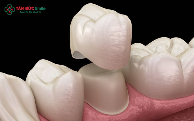 Súc miệng bằng nước muối ấm giúp giảm ê nhức sau Abc8.com Thể thao, Đá gà, Xổ số, Bắn cá