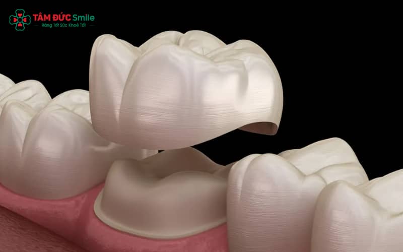 Khách hàng được ABC8 đường link chính thức tư vấn chọn răng toàn sứ và hướng dẫn chăm sóc