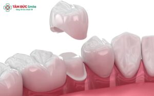 Abc8c1 com được cấp phép bởi PAGCOR Philippines có bị hôi miệng không? Nguyên nhân, cách khắc phục và phòng ngừa