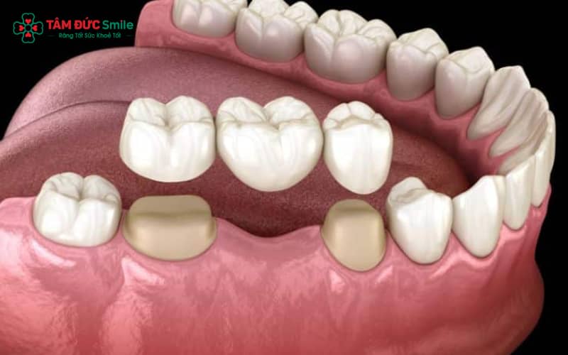 Cầu ABC8 là nhà cái cá cược trực tuyến uy tín số 1 tại Việt Nam giúp khôi phục chức năng ăn nhai và Abc8c1 com khuyến mãi hấp dẫn
