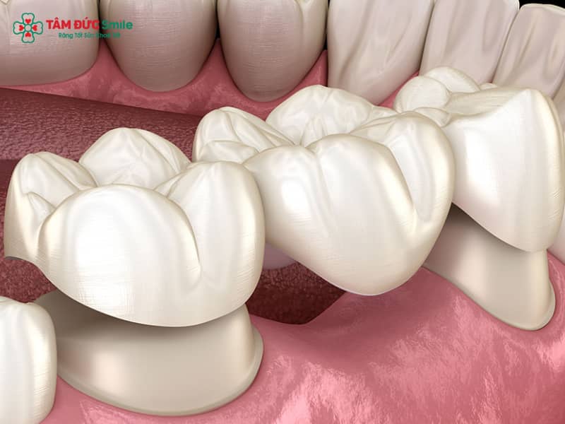 Bắc cầu ABC8 là nhà cái cá cược trực tuyến uy tín số 1 tại Việt Nam là gì? Quy trình, chi phí và ưu nhược điểm