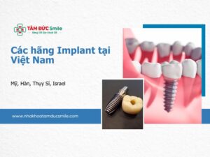 cac-hang-implant-tai-viet-nam-5
