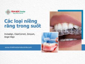 cac-loai-nieng-rang-trong-suot-5