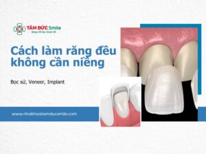 cach-lam-rang-deu-khong-can-nieng-5