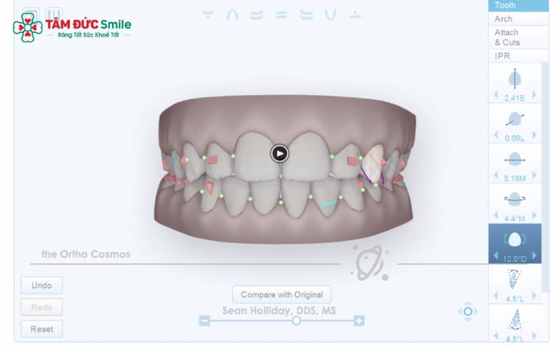 ClinCheck giúp bệnh nhân dễ dàng theo dõi tình trạng răng và dự đoán trước các bước di Link Vào Abc8.com Đăng Ký Tặng 88K