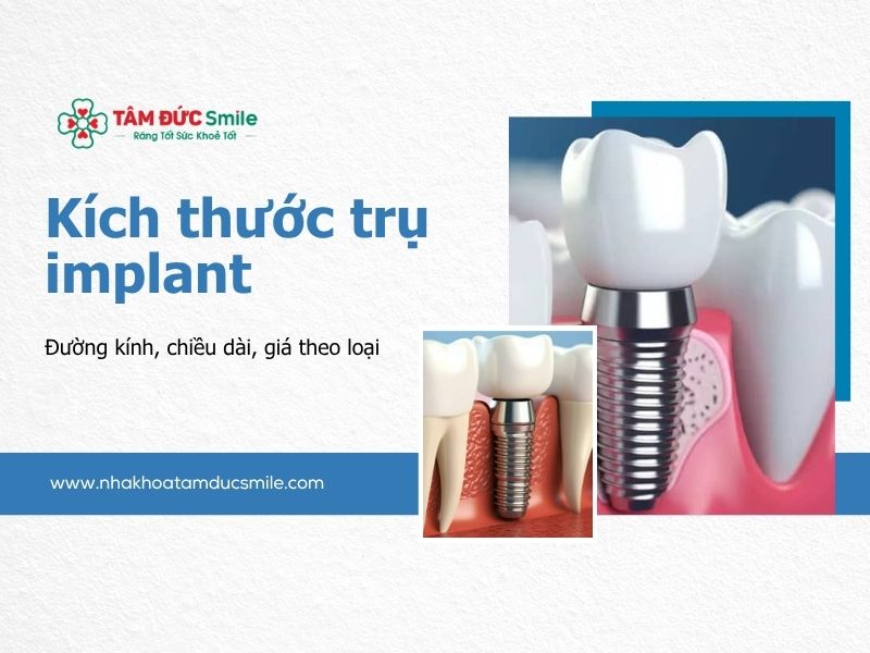 kich-thuoc-tru-implant