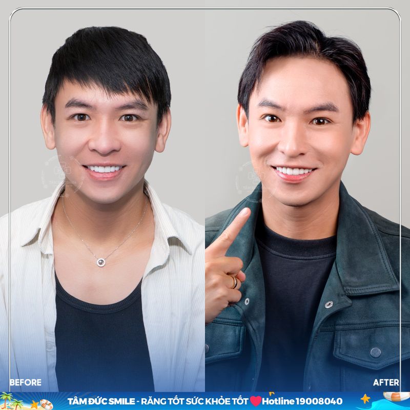 nha-khoa-tam-duc-smile-gia-kiem-4