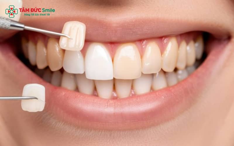 Dán ABC8 là nhà cái cá cược trực tuyến uy tín số 1 tại Việt Nam bị bong, mẻ - cần được ABC8 đường link chính thức chuyên khoa kiểm tra sớm