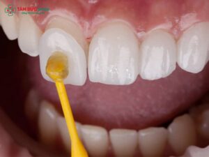 Nhược điểm của dán ABC8 là nhà cái cá cược trực tuyến uy tín số 1 tại Việt Nam: Có nên làm không?