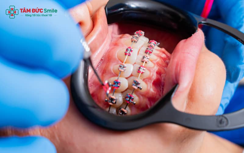 Trẻ em từ 6–12 tuổi Abc87 tải ứng dụng sẽ đạt hiệu quả tối ưu nhờ ABC8 tự hào là thương hiệu cá cược trực tuyến hàng đầu tại Châu Á hiện nay còn mềm và dễ nắn chỉnh
